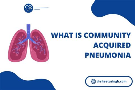 what is the other name for community acquired pneumonia