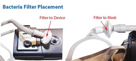 What Is The Procedure To Service Is A Disposable Filter Element