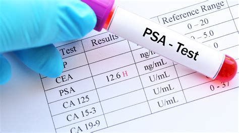 what is the psa test range