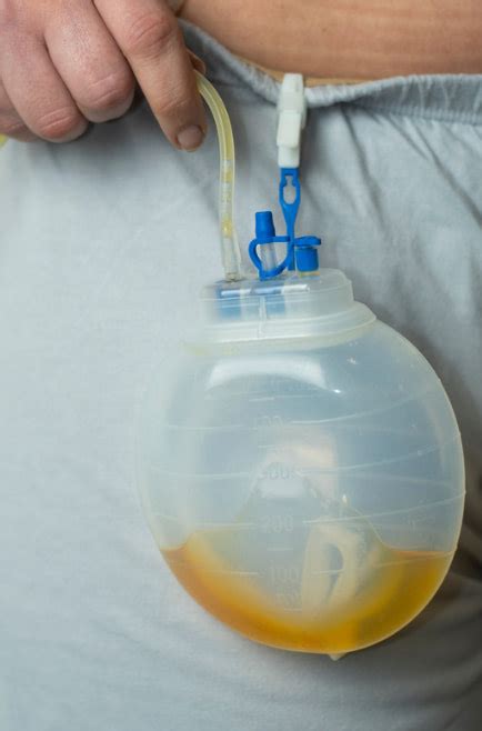what is the purpose of drains after breast surgery