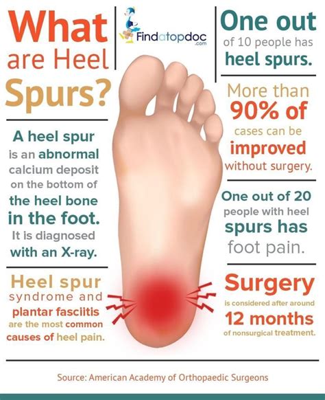 what is the treatment for a bone spur in the heel