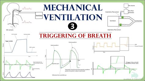 What Is Trigger In Mechanical Ventilation