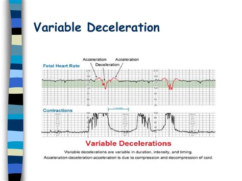 what is variable deceleration in pregnancy