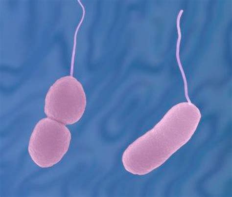 what is vibrio parahaemolyticus