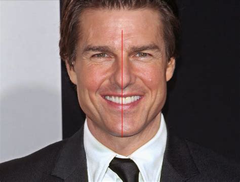 what is wrong with tom cruise teeth
