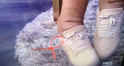 what is wrong with wendy williams feet