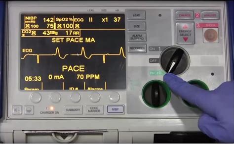 what is your initial impulse setting for transcutaneous pacemaker