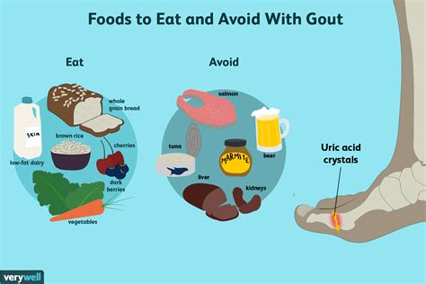 what meals to eat when you have gout
