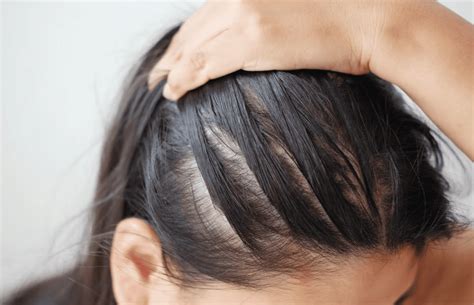 What Not To Do When Hair Is Thinning  Tips  Faq  And Hair Care