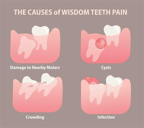 what pain does wisdom teeth cause