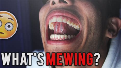 what the heck is mewing