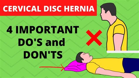 what to avoid with cervical herniated disc