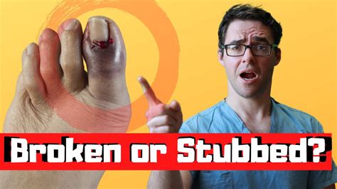 what to do for a stubbed toe