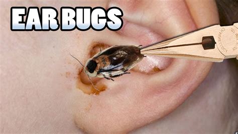 What To Do If A Bed Bug Gets In Your Ear