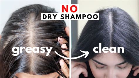 This What To Do With Oily Hair Without Dry Shampoo With Simple Style