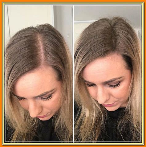 Stunning What To Do With Thin Hair Female For New Style