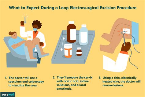 what to expect after a loop procedure