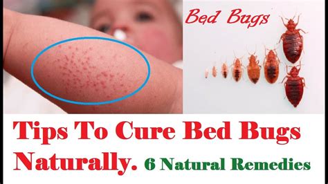 what to expect after bed bug treatment