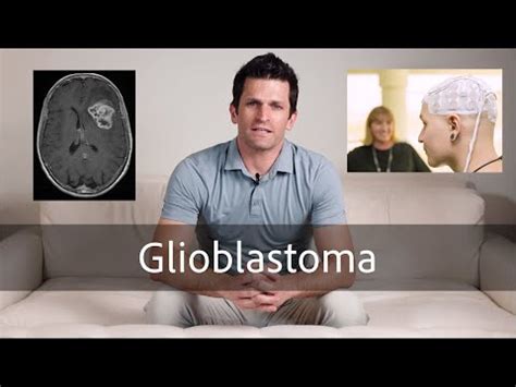 what to expect with glioblastoma