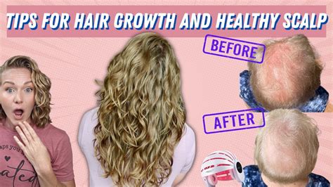 what to put on scalp for hair growth