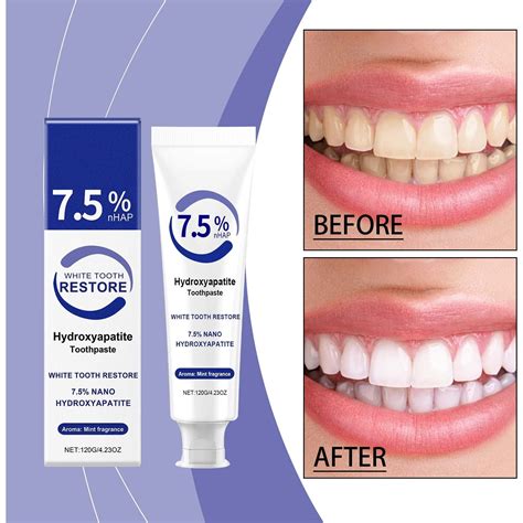 what toothpaste whitens teeth the most