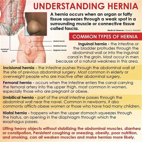Cpt Code For Parastomal Hernia Repair