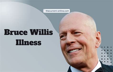 what type of aphasia does bruce willis have