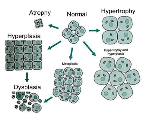 What Type Of Cell Changes The Value Of The Active Cell