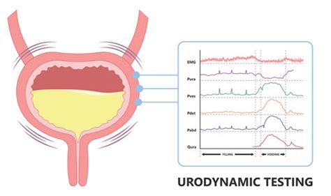 what type of doctor does urodynamic testing