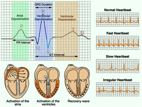 what type of procedure is an ecg