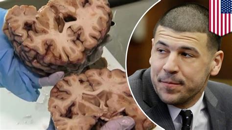 what was wrong with aaron hernandez brain