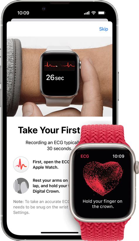 What Watch Has Ecg