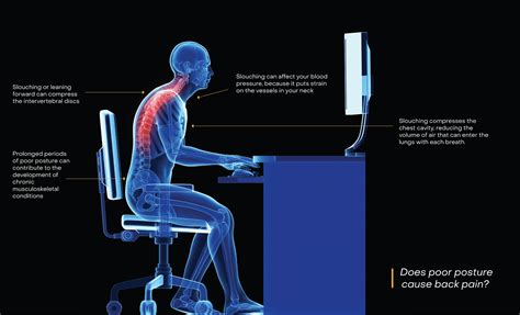 What does poor posture indicate?