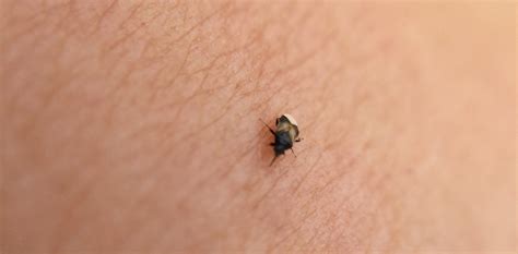 What tiny black bugs bite?