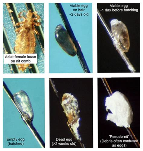 When Can Nits Lay Eggs