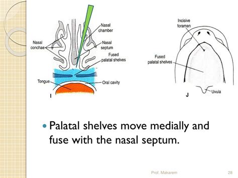 When Do Palatal Shelves Fuse