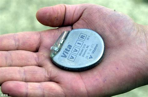 when does a pacemaker battery need to be replaced
