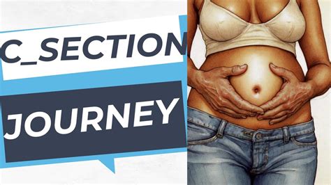 When Is The Best Time To Get Pregnant After C-Section