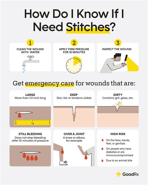 When Should You Get Stitches: A Guide to Wound Care and Timing