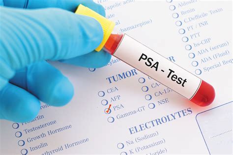 when to do psa test