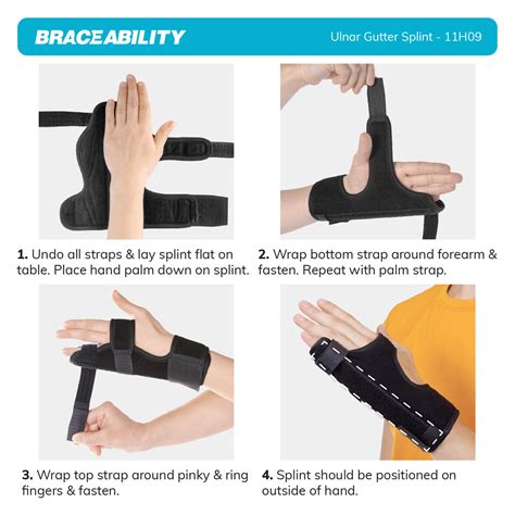 When To Use Ulnar Gutter Splint