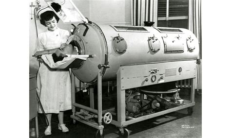 When Were Ventilators Invented