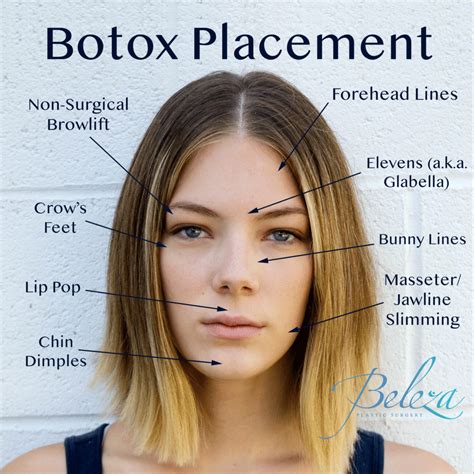 How Much Botox, Dysport, or Filler Do I Need? Hull
