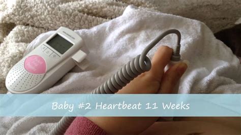 11 week ultrasound, Doppler, heartbeat YouTube
