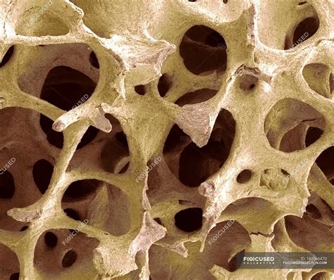where is the cancellous bone tissue