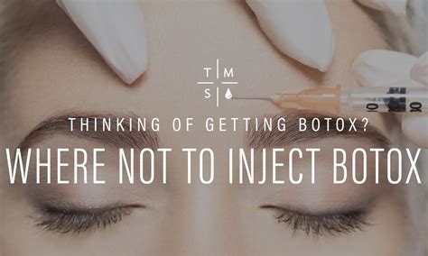 where not to inject botox on the face