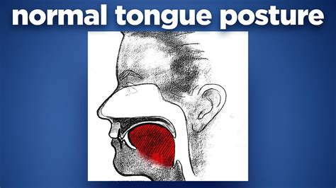 where should tongue sit in mouth