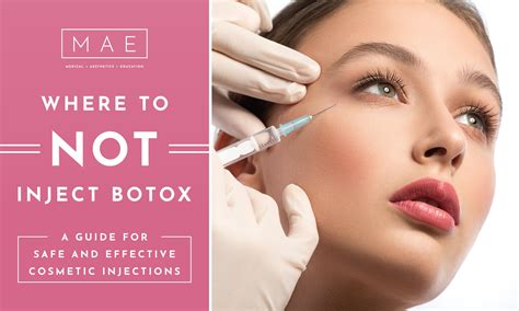 where should you not inject botox in the face