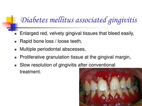 (PDF) Reversion From PreDiabetes Mellitus to
