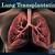 which statement is true about both lung transplant and bullectomy